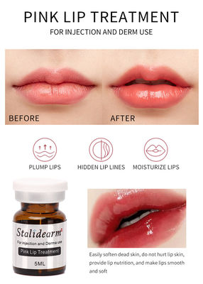 Διάλυμα Μεσοθεραπείας Exosome France Original Stalidearm Pink Lip Treatment Injectable Serum Set