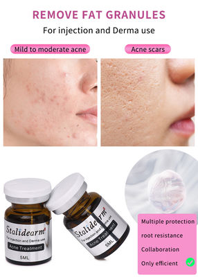 Εξοσωματικό ορό Γαλλία Stalidearm Skin Booster Μεσοθεραπεία Ορός Ενέσιμη Για τη θεραπεία της ανίασης