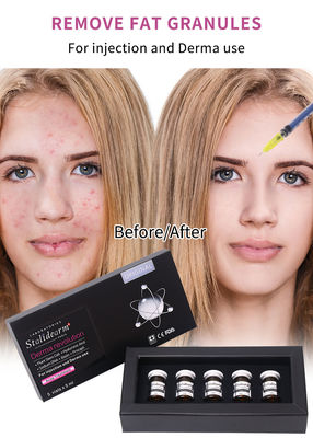 Εξοσωματικό ορό Γαλλία Stalidearm Skin Booster Μεσοθεραπεία Ορός Ενέσιμη Για τη θεραπεία της ανίασης