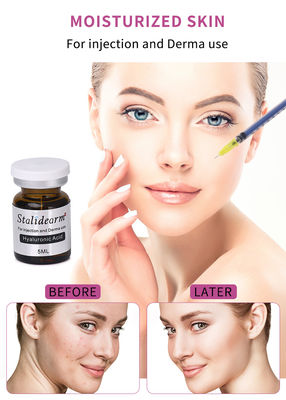 Θεραπεία με Εξωσώματα Skin Booster Υαλουρονικού Οξέος Ενέσιμος Ορός