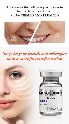 λεύκανση του ΜΕΣΟΥ ορού Mesotherapy ορών Microneedling ορών BOTOX για το πρόσωπο