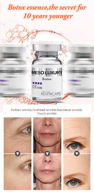 λεύκανση του ΜΕΣΟΥ ορού Mesotherapy ορών Microneedling ορών BOTOX για το πρόσωπο