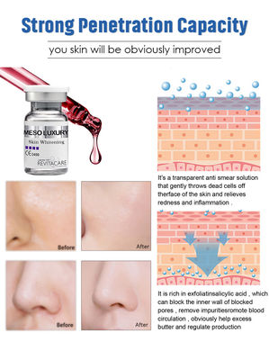 Ο μέσος ορός Microneedling ΠΟΛΥΤΕΛΕΙΑΣ απορρόφησε αμέσως το δέρμα που λευκαίνει την ουσία 10ML
