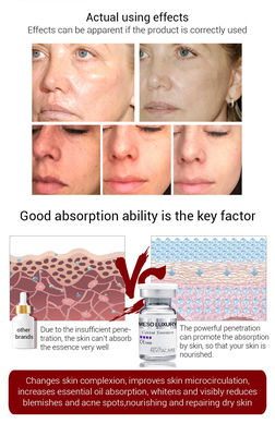 derma μέσος ορών Microneedling 10ml λαμπρύνοντας ορός γήρανσης χαβιαριών αντι