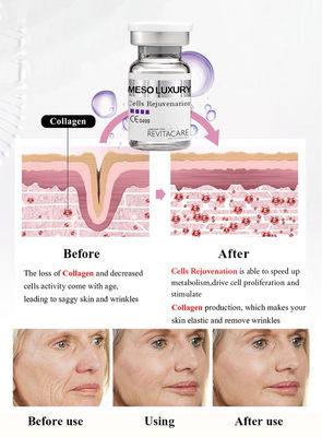 Μέση αντι γήρανση Microneedling ορών δύναμης Rejuvenating κυττάρων για τη λεύκανση δερμάτων