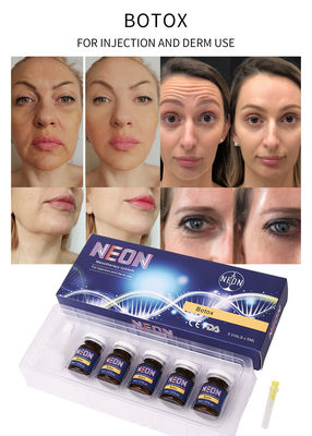 BOTOX μέσες θεραπείας εγχύσεις ρυτίδων ορών διαφανείς αντι