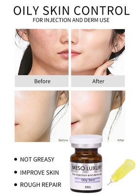 Θεραπεία με εξωσώματα Skin Booster MESO Serum Διάλυμα μεσοθεραπείας για λιπαρό δέρμα