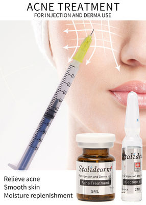 Εξόσωμα Skin Booster Γαλλία Αρχική Stalidearm Θεραπεία ακμής Ενέσιμη λύση μεσωθεραπείας ορού