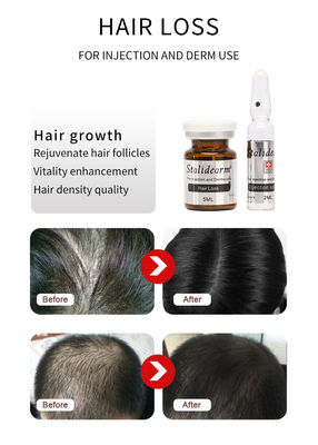 Ενέσιμο Serum Εξωσωματιδίων Μαλλιών France Original Stalidearm Hair Growth Mesotherapy Solution