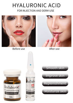 Hyaluronic όξινο νεολαίας ορών γήρανσης εγχύσεων 5ml αντι