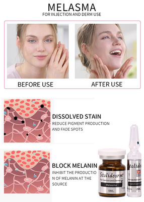 Ασφαλές και καλό σύνολο ορών Mesotherapy 5ml/bottle επίδρασης ορών χρήσης εγχύσεων Melasma
